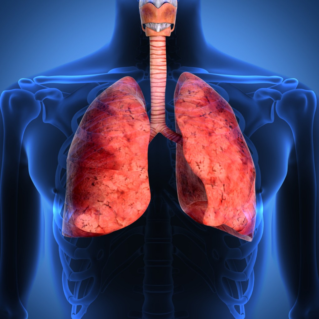 Researchers Find That Lung Cancer Patients with Brain