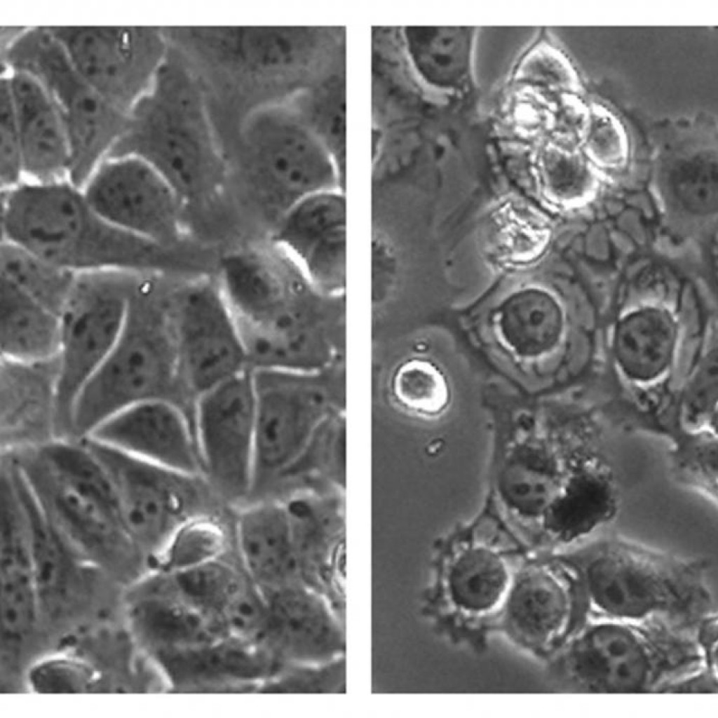 New Experimental Lung Cancer Therapy Overstimulates and