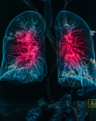 COPD-treatment-best-practices-317x400