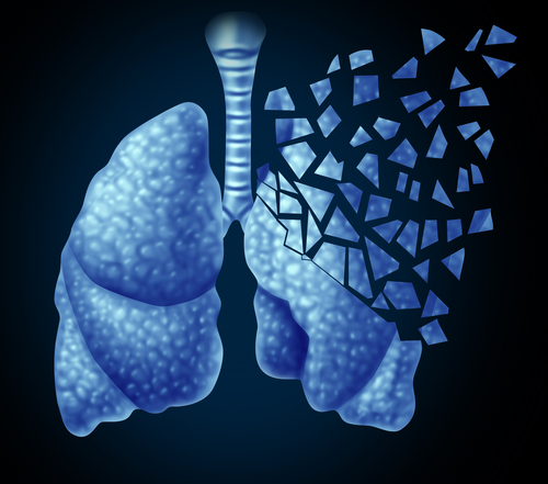 Novartis Announces Positive Data from Phase III FLAME Clinical Trial in COPD