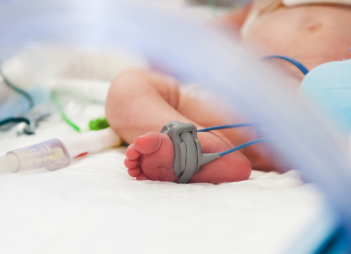 Oximetry Could Increase Unnecessary Bronchiolitis-Related Infant Hospitalizations