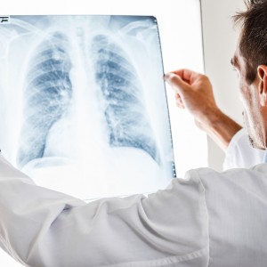 pulmonary embolism radiography