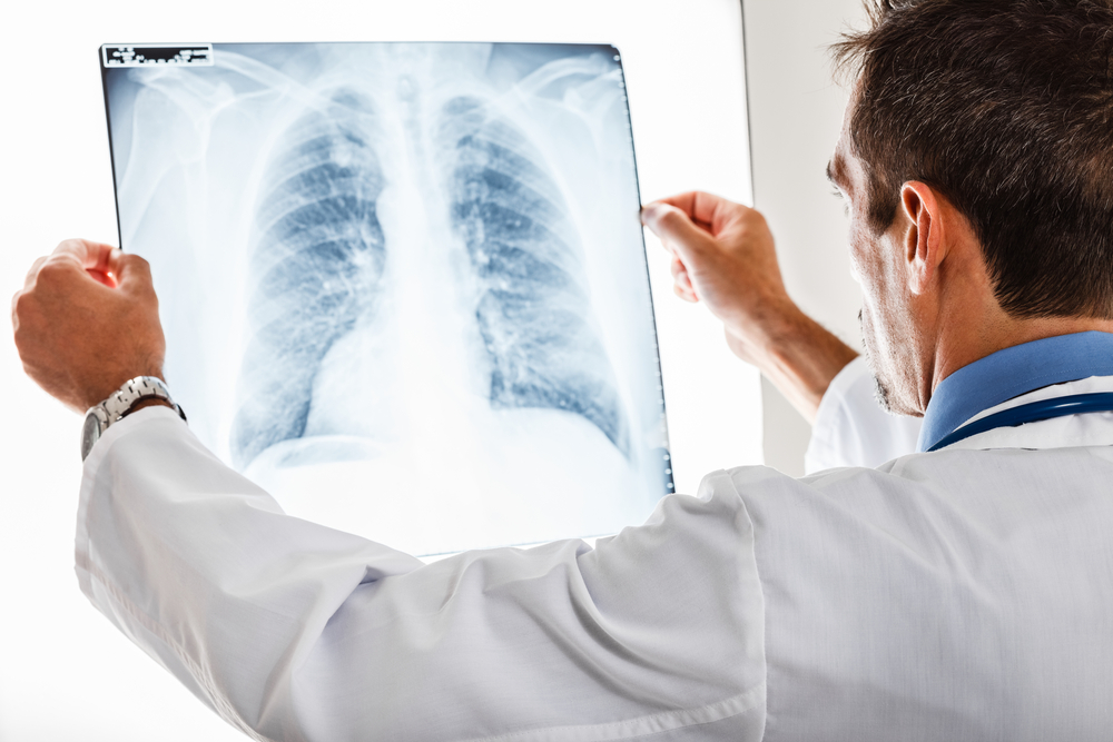 University Of Alabama At Birmingham Added To The National Pulmonary Fibrosis Care Network