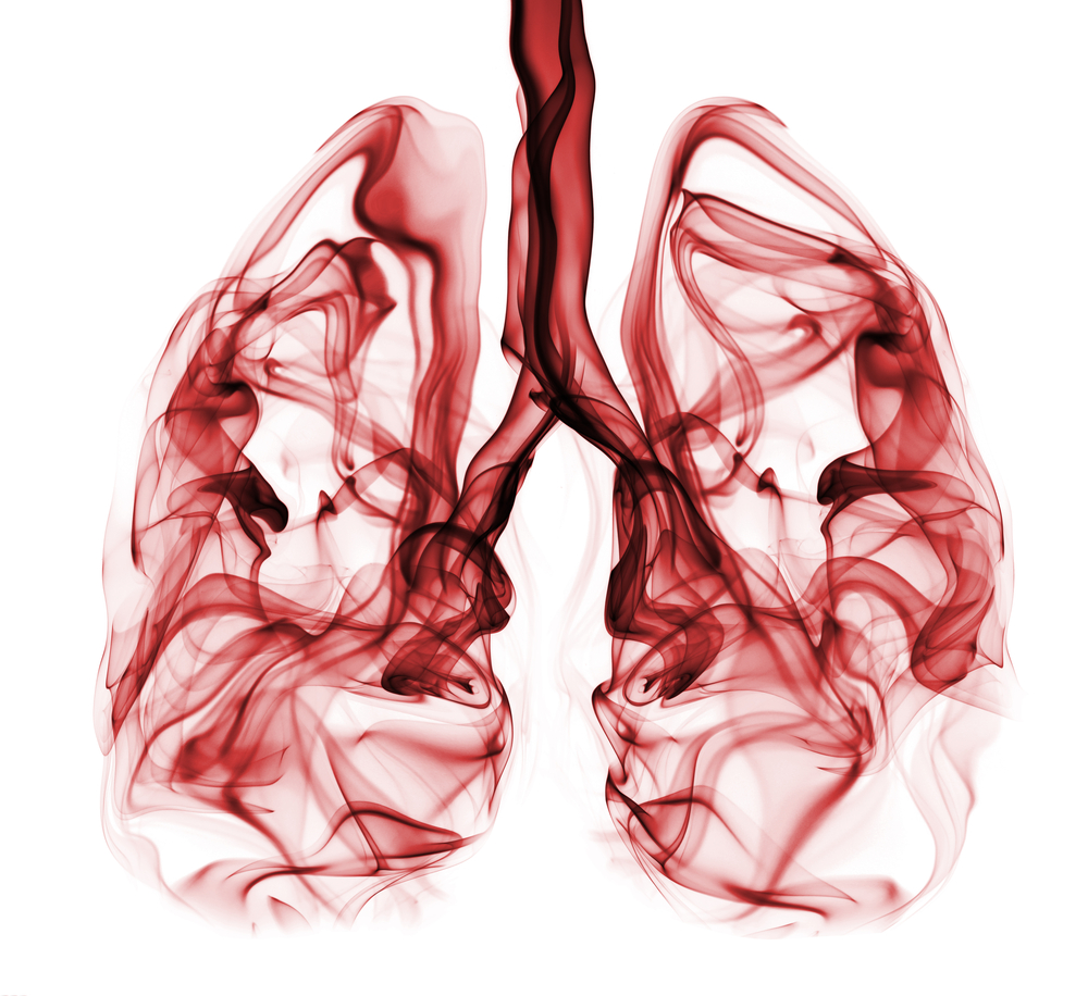 Pyruvate Carboxylase Enzyme Identified as Supporter of Tumor Growth in NSCLC
