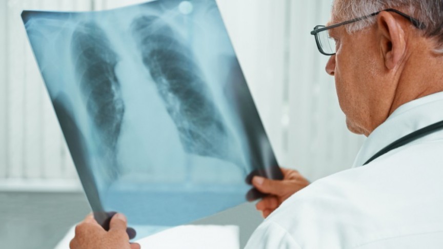 Clinical Trial Enrolling Lung Cancer Patients to Evaluate Two-Drug ...