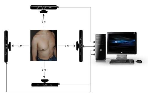 Researchers Build Promising CF Diagnostic System Using Microsoft’s Xbox Kinect Sensors
