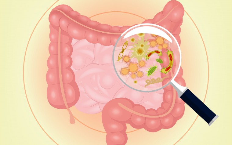 Kids with CF have altered gut bacterial flora